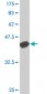 CD40 Antibody (monoclonal) (M01)