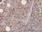 CD58 Antibody (monoclonal) (M01)