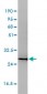 CD58 Antibody (monoclonal) (M01)