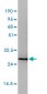 CD58 Antibody (monoclonal) (M01)