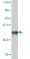 CD5L Antibody (monoclonal) (M01)