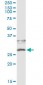 CD79B Antibody (monoclonal) (M01)