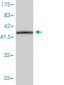 CD79B Antibody (monoclonal) (M01)