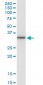 CD83 Antibody (monoclonal) (M01)