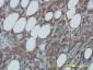 CDC37 Antibody (monoclonal) (M01)