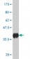 CDC42BPB Antibody (monoclonal) (M02)