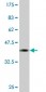 CDC42BPB Antibody (monoclonal) (M03)
