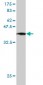 CDH17 Antibody (monoclonal) (M01)