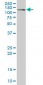 CDH17 Antibody (monoclonal) (M01)