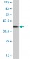 CDK4 Antibody (monoclonal) (M03)