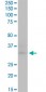 CDK4 Antibody (monoclonal) (M03)