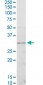 CDK4 Antibody (monoclonal) (M03)