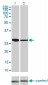 CDK4 Antibody (monoclonal) (M03)