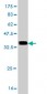 CDK4 Antibody (monoclonal) (M04)