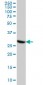 CDK4 Antibody (monoclonal) (M04)