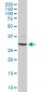 CDK4 Antibody (monoclonal) (M04)