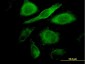 CDK4 Antibody (monoclonal) (M09)