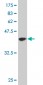 CDK4 Antibody (monoclonal) (M09)