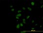 CDK5RAP3 Antibody (monoclonal) (M01)