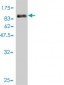 CDK5RAP3 Antibody (monoclonal) (M01)