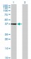 CDK6 Antibody (monoclonal) (M01)