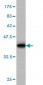CDKL4 Antibody (monoclonal) (M03)