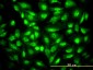 CDKN1B Antibody (monoclonal) (M01)