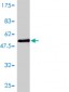 CDKN1B Antibody (monoclonal) (M01)