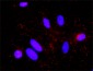 CDKN1B Antibody (monoclonal) (M01)