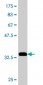 CDR2 Antibody (monoclonal) (M01)