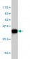 CELSR3 Antibody (monoclonal) (M01)