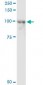 CENTB2 Antibody (monoclonal) (M01)