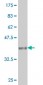 CER1 Antibody (monoclonal) (M04)