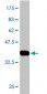 CES2 Antibody (monoclonal) (M01)