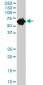 CES2 Antibody (monoclonal) (M01)