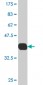 CES2 Antibody (monoclonal) (M02)