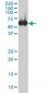 CES2 Antibody (monoclonal) (M02)