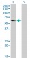CESK1 Antibody (monoclonal) (M01)