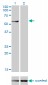 CESK1 Antibody (monoclonal) (M01)