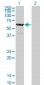 CESK1 Antibody (monoclonal) (M12)