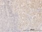 CFL1 Antibody (monoclonal) (M04)