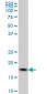 CFL1 Antibody (monoclonal) (M04)