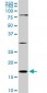 CFL1 Antibody (monoclonal) (M04)