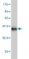 CFL2 Antibody (monoclonal) (M03)