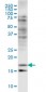 CFL2 Antibody (monoclonal) (M03)
