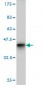 CHD3 Antibody (monoclonal) (M01)