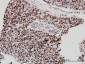CHD4 Antibody (monoclonal) (M01)
