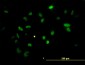 CHEK2 Antibody (monoclonal) (M01)