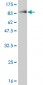 CHEK2 Antibody (monoclonal) (M01)