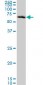 CHEK2 Antibody (monoclonal) (M01)